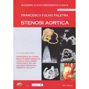 Quaderni di ecocardiografia clinica. Vol. 4: Stenosi aortica
