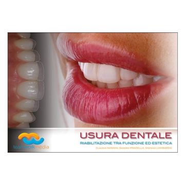 Usura Dentale. Riabilitazione tra funzione ed estetica [Lombardo Stefano, Nannini Claudio, Pradella Sandro - Teamwork Medica]