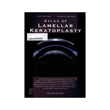 Atlas of lamellar keratoplasty. Con DVD [Fontana Luigi;Tassinari Giorgio - Fabiano]