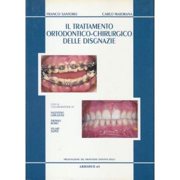 Il trattamento ortodontico chirurgico delle disgnazie