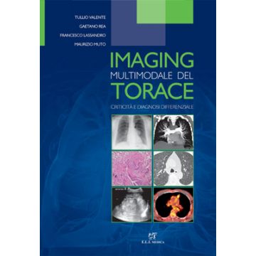 Tullio Valente - Imaging Multimodale del Torace. Criticità e diagnosi