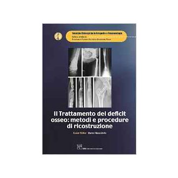 Il trattamento del deficit osse: Metodi e procedure di ricostruzione   [CIC Edizioni Internazionali]