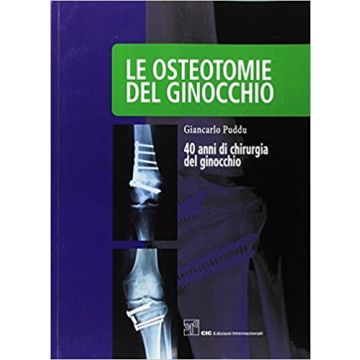 Le osteotomie del ginocchio