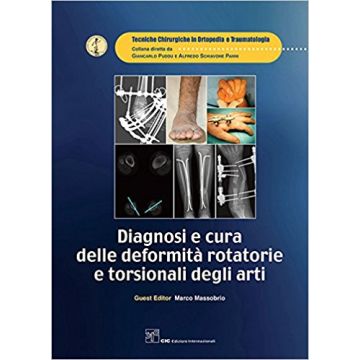 Diagnosi e cura delle deformità rotatorie e torsionali degli arti 