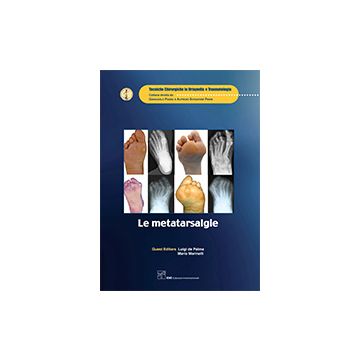Le metatarsalgie