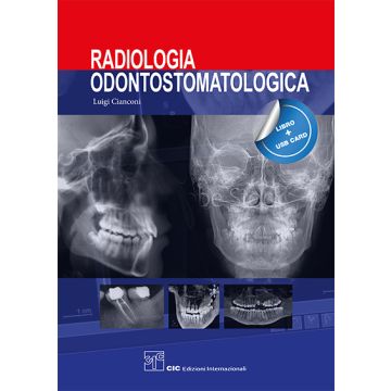 Cianconi Radiologia odontostomatologica cic edizioni