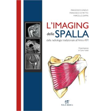 L' imaging della spalla - Dalla radiologia tradizionela all' Artro - RM (Artroscopia Risonanza Magnetica - ELI Medica - Ginolfi, Di Petto, Zappia)
