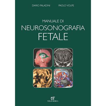 Manuale di neurosonografia fetale (Paladini Dario; Volpe Paolo - ELI Medica)
