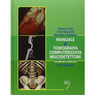 Manuale di Tomografia Computerizzata Multidetettore  [Dore Magnaldi Zompatori - Poletto]