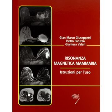 Risonanza Magnetica mammaria - Istruzioni per l'uso