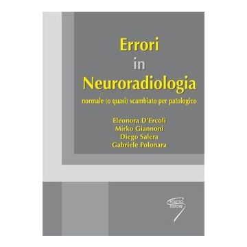 Errori in neuroradiologia - normale (o quasi) scambiato per patologico [D'Ercoli - Poletto]