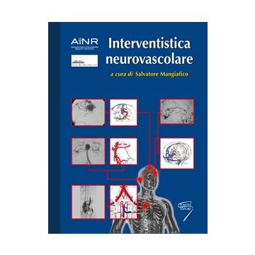 AINR Interventistica Neurovascolare Mangiafico Salvatore