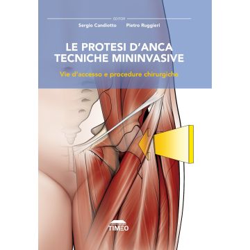 Le protesi d'anca. Tecniche mininvasive. Vie d'accesso e procedure chirurgiche - Candiotto Sergio; Ruggieri Pietro - Timeo