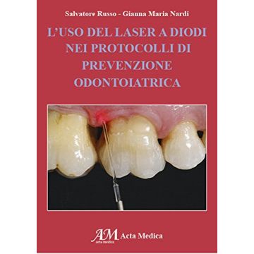 Salvatore Russo - L'uso del laser a Diodi nei protoccolli di prevenzione odontiatrica