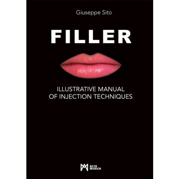 Filler. Illustrative manual of injection techniques. Ediz. illustrata