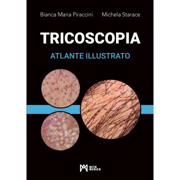 Tricoscopia Atlante illustrato Malattie dei capelli e del cuoio capelluto Piraccini Bianca Maria Starace Michela Acta Medica