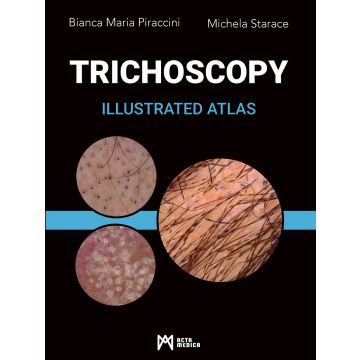 Trichoscopy. Illustrated atlas (Piraccini Bianca Maria;Starace Michela - Acta medica edizioni)