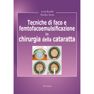 Tecniche di faco e femtofacoemulsificazione in chirurgia della cataratta