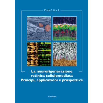 La Neurorigenerazione Retinica cellulomediata Principi, applicazioni e prospettive
