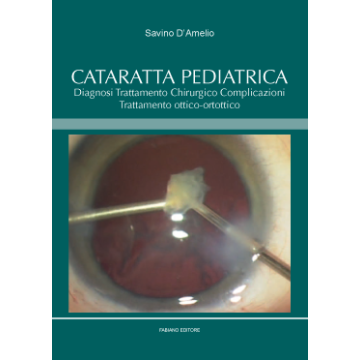CATARATTA PEDIATRICA - Diagnosi Trattamento Chirurgico Complicazioni Trattamento ottico-ortottico