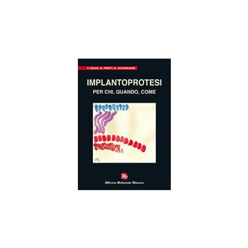 Implantoprotesi : Per chi - quando - come [Bassi; Preti - OEO Officina Editoriale]