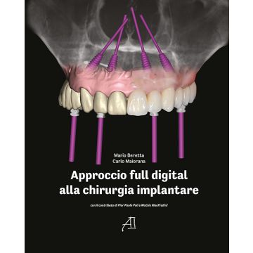 Approccio ful digital alla chirurgia implantare mario beretta carlo maiorana ariesdue edizioni libro