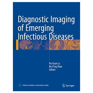 Diagnostic Imaging of Emerging Infectious Diseases  Lu Pu-Xuan; Zhou Bo-Ping  Springer Verlag  9789401773621