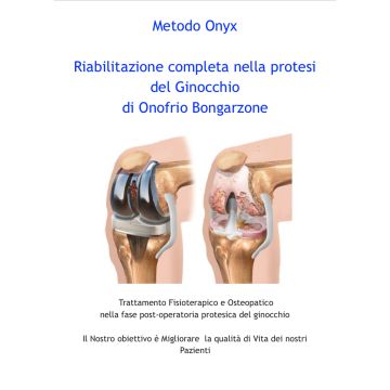 Riabilitazione completa nella protesi del ginocchio. Trattamento fisioterapico e osteopatico nella fase post-operatoria protesica del ginocchio (Bongarzone Onofrio)