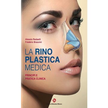 La rinoplastica medica. Principi e pratica clinica  [Alessio Redaelli; Frederic Braccini- Officina Editoriale Firenze]