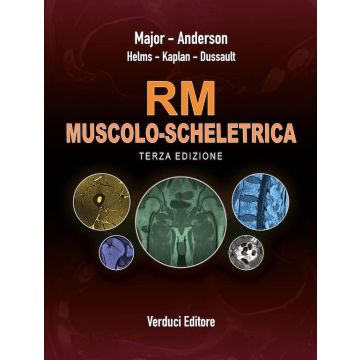 Major Anderson kaplan RM MUSCOLO SCHELETRICA RISONANZA MAGNETICA VERDUCI 