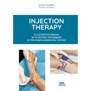 Injection therapy. Illustrative manual of injection techniques in the musculoskeletal system [Frizziero Antonio - Timeo]