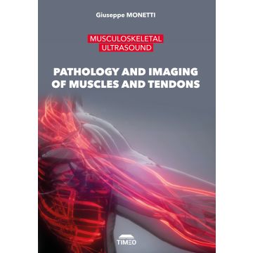 Musculoskeletal ultrasound. Pathology and imaging of muscles and tendons Monetti Giuseppe Timeo