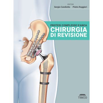 Protesi complesse d'anca. Chirurgia di revisione [Candiotto Sergio; Ruggieri Pietro - Timeo]
