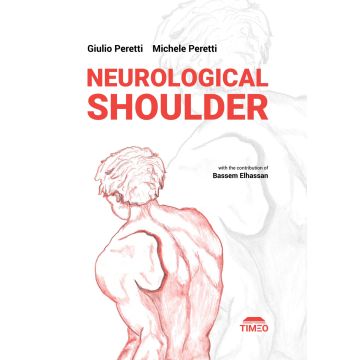 Neurological shoulder