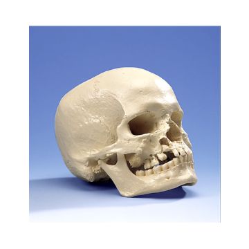 Cranio microcefalo