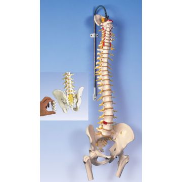 Colonna vertebrale flessibile, modello di lusso, con Ernia del disco dorsolaterale tra L3 e L4, tronchi del femore mobili