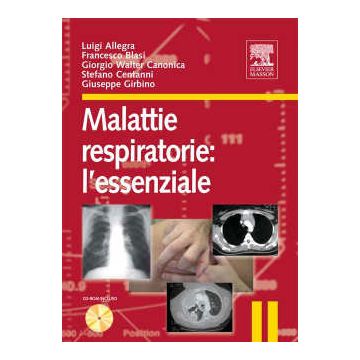 Malattie Respiratorie: l’essenziale + CD Rom [Allegra; Blasi - Elsevier Masson]