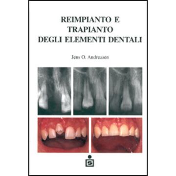 Reimpianto e trapianto degli elementi dentali  [Andreasen - Scienza e Tecnica Dentistica]