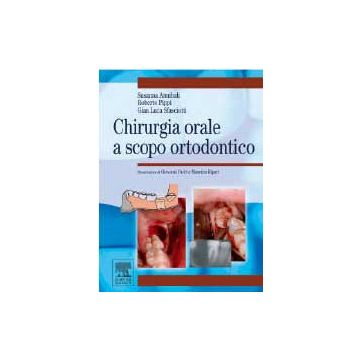 Chirurgia orale a scopo ortodontico [Annibali - Elsevier Masson Italia]