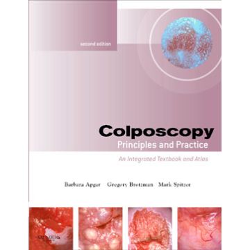 Colposcopy, 2nd Edition - Principles and Practice, Text with DVD