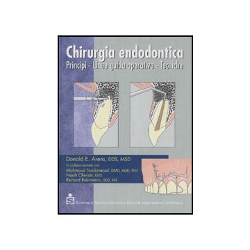 Chirurgia endodontica - Principi - Linee guida operative - Tecniche