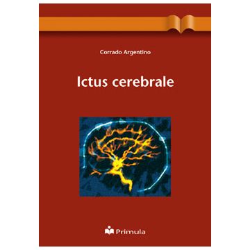 Ictus cerebrale