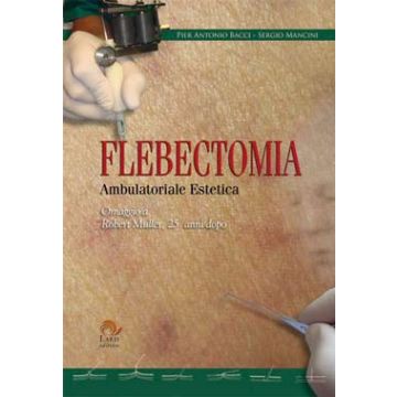 FLEBECTOMIA - Ambulatoriale Estetica