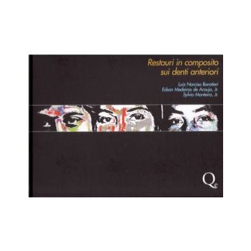 Restauri in Composito sui Denti Anteriori [Baratieri - Quintessenza Edizioni]