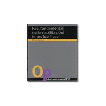 Fasi fondamentali nelle riabilitazioni in protesi fissa