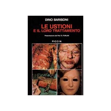 Le ustioni e il loro trattamento