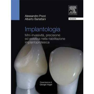 IMPLANTOLOGIA - Mini-invasività, Precisione ed Estetica nella Riabilitazione Implantoprotesica [Pozzi - Elsevier Masson]
