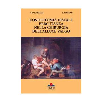 L'osteotomia distale percutanea nella chirurgia dell'alluce valgo