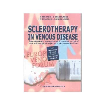 Sclerotherapy in venous disease. Investigations, management, treatment, surgical and non-surgical approach to venous diseases