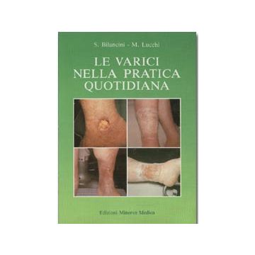 Le varici nella pratica quotidiana